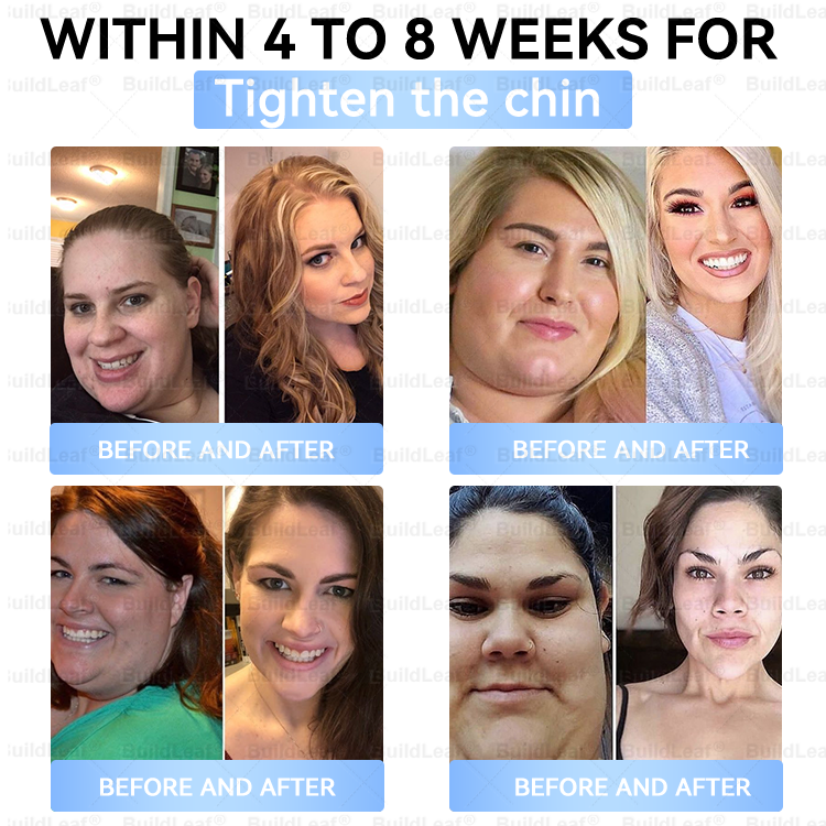 FDA Store|𝐵uil𝗱𝐿ea𝐟® 𝑮𝐋𝑃-1 Slim & Firm 𝑁ano 𝑀icroneedle 𝑃atch with Collagen,Turmeric&Matrixyl 3000 丨Obesity,Cardiovascular Diseas, Diabetes, Sleep Apnea, Joint Problems and More✨