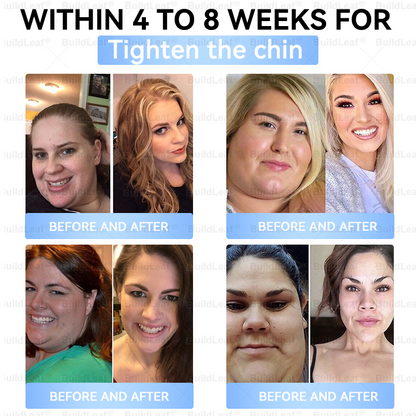 FDA Store|𝐵uil𝗱𝐿ea𝐟® 𝑮𝐋𝑃-1 Slim & Firm 𝑁ano 𝑀icroneedle 𝑃atch with Collagen,Turmeric&Matrixyl 3000 丨Obesity,Cardiovascular Diseas, Diabetes, Sleep Apnea, Joint Problems and More✨