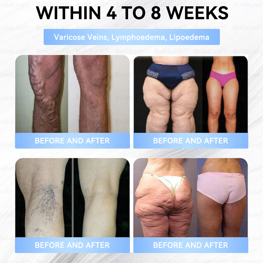 FDA Store|𝐵uil𝗱𝐿ea𝐟® 𝑮𝐋𝑃-1 Slim & Firm 𝑁ano 𝑀icroneedle 𝑃atch with Collagen,Turmeric&Matrixyl 3000 丨Obesity,Cardiovascular Diseas, Diabetes, Sleep Apnea, Joint Problems and More✨
