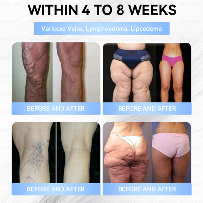FDA Store|𝐵uil𝗱𝐿ea𝐟® 𝑮𝐋𝑃-1 Slim & Firm 𝑁ano 𝑀icroneedle 𝑃atch with Collagen,Turmeric&Matrixyl 3000 丨Obesity,Cardiovascular Diseas, Diabetes, Sleep Apnea, Joint Problems and More✨