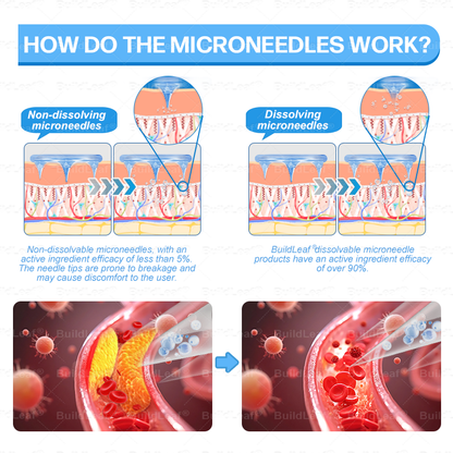 FDA Store|𝐵uil𝗱𝐿ea𝐟® 𝑮𝐋𝑃-1 Slim & Firm 𝑁ano 𝑀icroneedle 𝑃atch with Collagen,Turmeric&Matrixyl 3000 丨Obesity,Cardiovascular Diseas, Diabetes, Sleep Apnea, Joint Problems and More✨