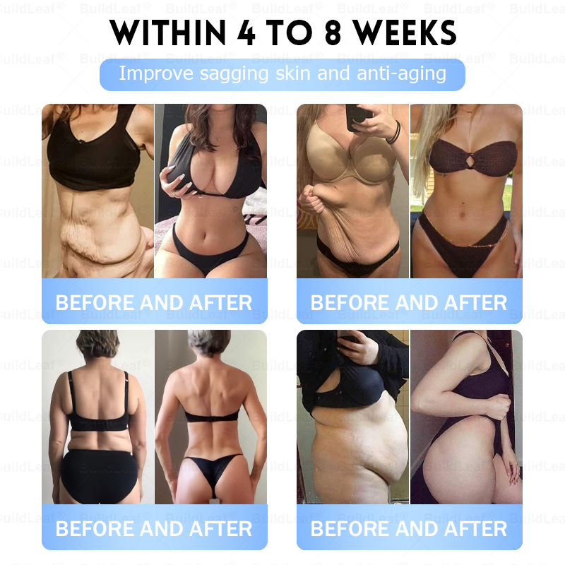 FDA Store|𝐵uil𝗱𝐿ea𝐟® 𝑮𝐋𝑃-1 Slim & Firm 𝑁ano 𝑀icroneedle 𝑃atch with Collagen,Turmeric&Matrixyl 3000 丨Obesity,Cardiovascular Diseas, Diabetes, Sleep Apnea, Joint Problems and More✨