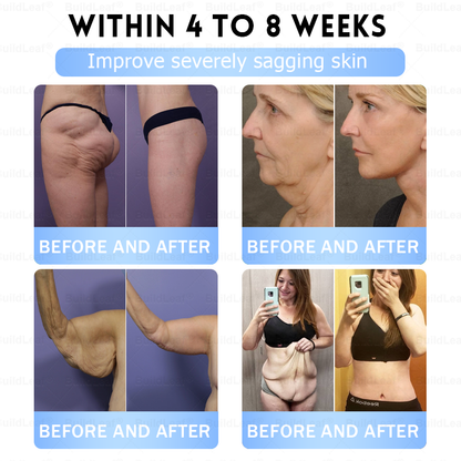 FDA Store|𝐵uil𝗱𝐿ea𝐟® 𝑮𝐋𝑃-1 Slim & Firm 𝑁ano 𝑀icroneedle 𝑃atch with Collagen,Turmeric&Matrixyl 3000 丨Obesity,Cardiovascular Diseas, Diabetes, Sleep Apnea, Joint Problems and More✨