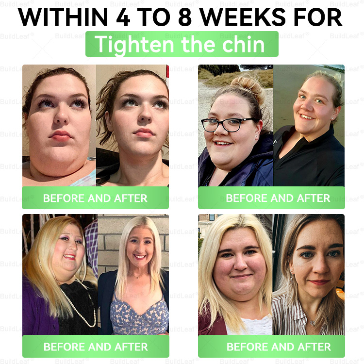 FDA 𝖮𝖿𝖿𝗂𝖼𝗂𝖺𝗅 𝖲𝗍𝗈𝗋𝖾 | 𝑩𝒖𝐢𝒍𝒅𝑳𝒆𝐚𝒇® GL𝐏-1 6-𝒊𝒏-1 𝑯𝒆𝒂𝒍𝒕𝒉 𝑺𝒐𝒍𝒖𝒕𝒊𝒐𝒏 𝖮𝗋𝖺𝗅 𝐋𝐢𝐪𝐮𝐢𝐝(𝑂𝑛𝑐𝑒 𝑎 𝑑𝑎𝑦, 𝑣𝑖𝑠𝑖𝑏𝑙𝑒 𝑟𝑒𝑠𝑢𝑙𝑡𝑠 𝑖𝑛 7 𝑑𝑎𝑦𝑠)  ✅ 𝗦𝘂𝗽𝗽𝗼𝗿𝘁𝘀 𝗼𝗯𝗲𝘀𝗶𝘁𝘆, 𝗰𝗮𝗿𝗱𝗶𝗼𝘃𝗮𝘀𝗰𝘂𝗹𝗮𝗿 𝗵𝗲𝗮𝗹𝘁𝗵, 𝗱𝗶𝗮𝗯𝗲𝘁𝗲𝘀, 𝘀𝗹𝗲𝗲𝗽 𝗮𝗽𝗻𝗲𝗮, 𝗴𝘂𝘁 𝗵𝗲𝗮𝗹𝘁𝗵, 𝗷𝗼𝗶𝗻𝘁 𝗶𝘀𝘀𝘂𝗲𝘀, 𝐰𝐡𝐢𝐥𝐞 𝐚𝐥𝐬𝐨 𝐟𝐢𝐫𝐦𝐢𝐧𝐠 𝐭𝐡𝐞 𝐬𝐤𝐢𝐧 𝐚𝐧𝐝 𝐛𝐨𝐨𝐬𝐭𝐢𝐧𝐠 𝐞𝐧𝐞𝐫𝐠𝐲